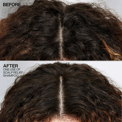DANDRUFF CONTROL SHAMPOO